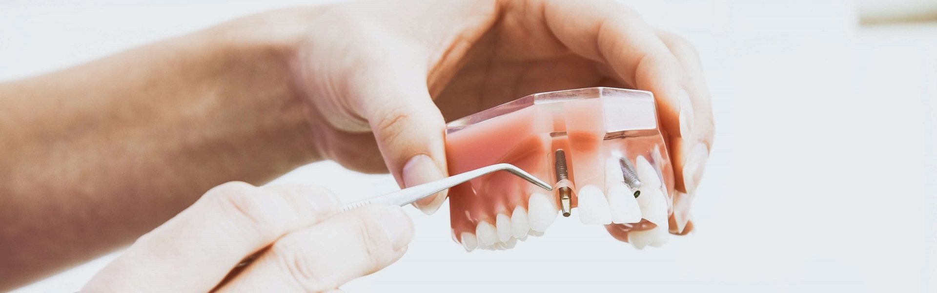 Sprej za grlo | Zubni implanti